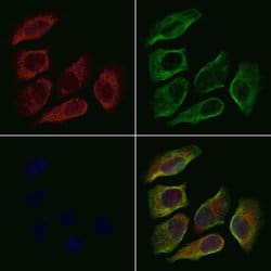 Invitrogen RPL35A Polyclonal Antibody 100 &mu;L | Buy Online | Invitrogen&trade; | Fisher Scientific