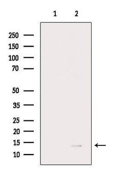 Invitrogen RPL35A Polyclonal Antibody 100 &mu;L | Buy Online | Invitrogen&trade; | Fisher Scientific