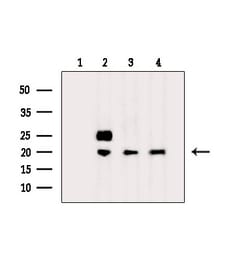Invitrogen RPL36AL Polyclonal Antibody 100 &mu;L; Unconjugated:Antibodies,