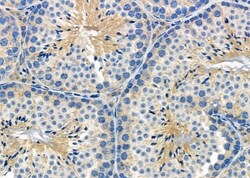 Invitrogen RPL38 Polyclonal Antibody 100 &mu;L; Unconjugated:Antibodies,