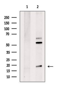 Invitrogen RPL38 Polyclonal Antibody 100 &mu;L; Unconjugated:Antibodies,