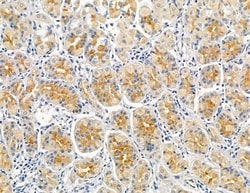 Invitrogen INPP5E Polyclonal Antibody 100 &mu;L; Unconjugated:Antibodies,