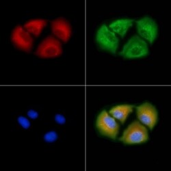 Invitrogen ABHD1 Polyclonal Antibody 100 &mu;L; Unconjugated:Antibodies,
