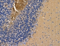 Invitrogen ABHD1 Polyclonal Antibody 100 &mu;L; Unconjugated:Antibodies,
