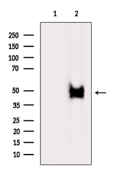 Invitrogen ABHD1 Polyclonal Antibody 100 &mu;L; Unconjugated:Antibodies,
