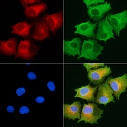 Invitrogen ABHD10 Polyclonal Antibody 100 &mu;L; Unconjugated:Antibodies,