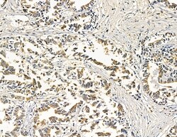 Invitrogen ABHD10 Polyclonal Antibody 100 &mu;L; Unconjugated:Antibodies,