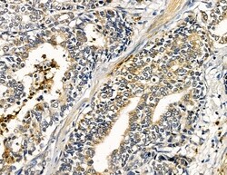 Invitrogen ABHD10 Polyclonal Antibody 100 &mu;L; Unconjugated:Antibodies,
