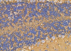 Invitrogen ABHD10 Polyclonal Antibody 100 &mu;L; Unconjugated:Antibodies,