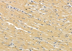 Invitrogen ABHD10 Polyclonal Antibody 100 &mu;L; Unconjugated:Antibodies,