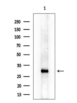 Invitrogen ABHD10 Polyclonal Antibody 100 &mu;L; Unconjugated:Antibodies,