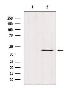 Invitrogen ABHD13 Polyclonal Antibody 100 &mu;L; Unconjugated:Antibodies,