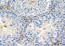 Invitrogen CHRNG Polyclonal Antibody 100 &mu;L; Unconjugated:Antibodies,