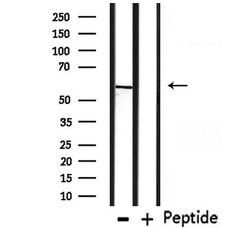 Invitrogen CHRNG Polyclonal Antibody 100 &mu;L; Unconjugated:Antibodies,