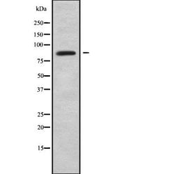 Invitrogen ABLIM1 Polyclonal Antibody 100 &mu;L | Buy Online | Invitrogen&trade; | Fisher Scientific