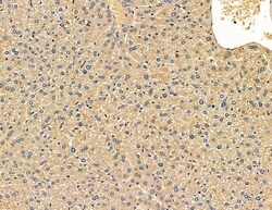 Invitrogen ACAD9 Polyclonal Antibody 100 &mu;L; Unconjugated:Antibodies,