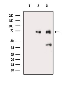 Invitrogen ACAD9 Polyclonal Antibody 100 &mu;L; Unconjugated:Antibodies,