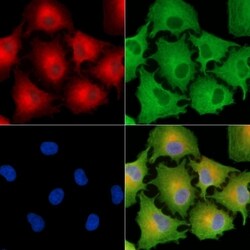 Invitrogen LPGAT1 Polyclonal Antibody 100 &mu;L; Unconjugated:Antibodies,