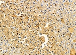 Invitrogen LPGAT1 Polyclonal Antibody 100 &mu;L; Unconjugated:Antibodies,