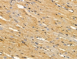 Invitrogen LPGAT1 Polyclonal Antibody 100 &mu;L; Unconjugated:Antibodies,