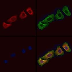 Invitrogen ACBD5 Polyclonal Antibody 100 &mu;L; Unconjugated:Antibodies,