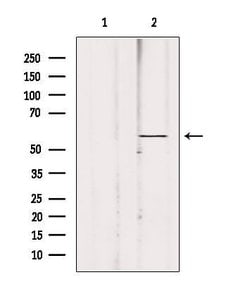 Invitrogen ACBD5 Polyclonal Antibody 100 &mu;L; Unconjugated:Antibodies,
