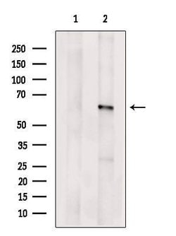Invitrogen ACBD5 Polyclonal Antibody 100 &mu;L; Unconjugated:Antibodies,
