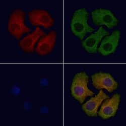 Invitrogen ACOX3 Polyclonal Antibody 100 &mu;L; Unconjugated:Antibodies,