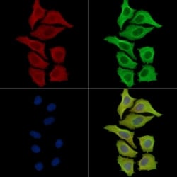 Invitrogen ACOT9 Polyclonal Antibody 100 &mu;L; Unconjugated:Antibodies,