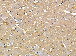 Invitrogen ACOT9 Polyclonal Antibody 100 &mu;L; Unconjugated:Antibodies,