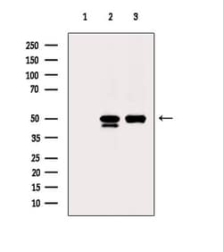 Invitrogen ACOT9 Polyclonal Antibody 100 &mu;L; Unconjugated:Antibodies,