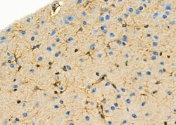 Invitrogen AOAH Polyclonal Antibody 100 &mu;L; Unconjugated:Antibodies,