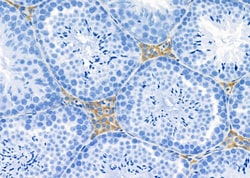 Invitrogen AOAH Polyclonal Antibody 100 &mu;L; Unconjugated:Antibodies,