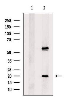 Invitrogen ACYP2 Polyclonal Antibody 100 &mu;L; Unconjugated:Antibodies,