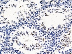 ADAM30 Polyclonal Antibody, Invitrogen 100 &mu;L; Unconjugated:Antibodies,