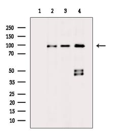 ADAM30 Polyclonal Antibody, Invitrogen 100 &mu;L; Unconjugated:Antibodies,