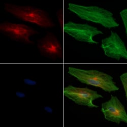 Invitrogen ADAM33 Polyclonal Antibody 100 &mu;L; Unconjugated:Antibodies,
