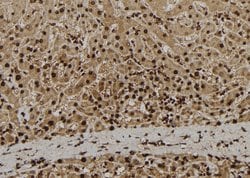Invitrogen ADAM33 Polyclonal Antibody 100 &mu;L; Unconjugated:Antibodies,