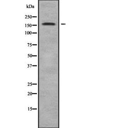 Invitrogen ADAMTS13 Polyclonal Antibody 100 &mu;L; Unconjugated:Antibodies,