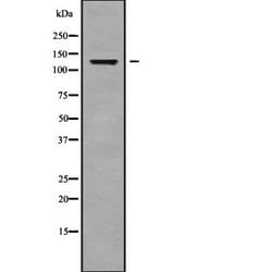 Invitrogen ADAMTS14 Polyclonal Antibody 100 &mu;L; Unconjugated:Antibodies,