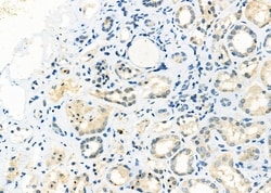 Invitrogen ADAMTS16 Polyclonal Antibody 100 &mu;L; Unconjugated:Antibodies,