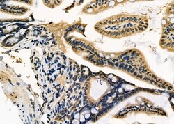 ADAMTS20 Polyclonal Antibody, Invitrogen 100 &mu;L; Unconjugated:Antibodies,