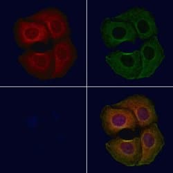 Invitrogen GPT2 Polyclonal Antibody 100 &mu;L; Unconjugated:Antibodies,