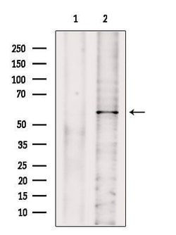 Invitrogen GPT2 Polyclonal Antibody 100 &mu;L; Unconjugated:Antibodies,