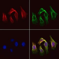 Invitrogen AGXT2 Polyclonal Antibody 100 &mu;L; Unconjugated:Antibodies,
