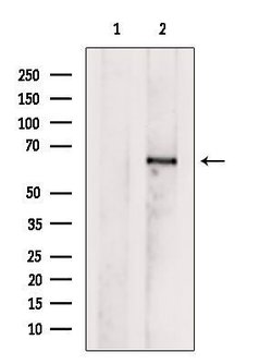 Invitrogen AGXT2 Polyclonal Antibody 100 &mu;L; Unconjugated:Antibodies,