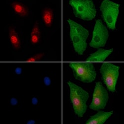 Invitrogen RPP25L Polyclonal Antibody 100 &mu;L; Unconjugated:Antibodies,