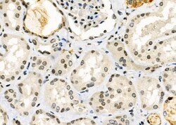 Invitrogen RPP25L Polyclonal Antibody 100 &mu;L; Unconjugated:Antibodies,