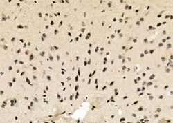 Invitrogen RPP25L Polyclonal Antibody 100 &mu;L; Unconjugated:Antibodies,