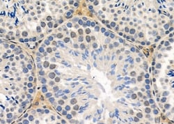 Invitrogen RPP25L Polyclonal Antibody 100 &mu;L; Unconjugated:Antibodies,